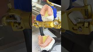 Patient example tmj case with years of suffering jaw pain gone in minutes tmjtreatment dentist [upl. by Turpin]