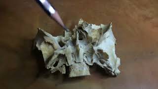 Sphenoid Bangla Demo [upl. by Lednam57]