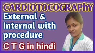 Cardiotocography in hindi  Electronic fetal monitor Type of CTG  purpose of CTG Procedure of CTG [upl. by Devine]