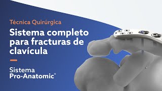 ProAnatomic®  Sistema completo de fracturas de clavícula [upl. by Sammer]