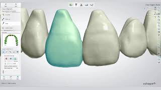 3Shape Clear Aligner Studio workflow with Bernhard Egger [upl. by Vaughn]