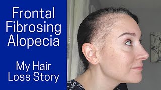 Frontal Fibrosing Alopecia  My Symptoms Diagnosis Treatments [upl. by Shipley]