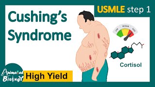 Cushings syndrome  How is Cushing syndrome diagnosed  Treatment of Cushings syndrome  USMLE [upl. by Natala]