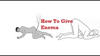 How To Give Enema  Demonastration and See Procedure [upl. by Aihsein150]