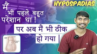 Successful Hypospadias Surgeon in Kolkata  मूत्र का छिद्र सही जगह पर न खुलने की समस्या  Dr Nagwani [upl. by Anivlis480]