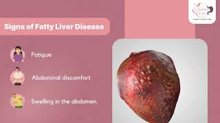 Fatty liver [upl. by Eilraep]