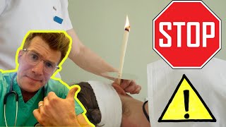 Is ear candling safe to remove ear wax Doctor explains shorts [upl. by Ming]