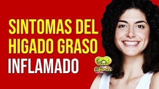 10 Sintomas Del Higado Graso E Inflamado  Sintomas De Problemas Enfermedades Y Dolor Del Higado [upl. by Leia282]