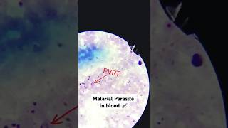 Malaria parasiteshotslikeshorts likeforlikesmedicallaboratorywatch sciencetrendingyoutuber [upl. by Schapira]