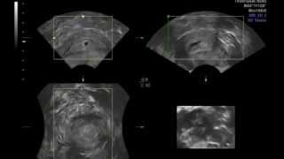 Ecografia 16 semanas 4D y 2D Ultrasound Irati [upl. by Adnuhsor715]