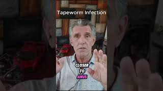 Tapeworm Infection [upl. by Aldred]