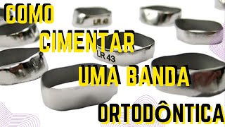 Como cimentar uma banda ortodôntica  Aula 129 [upl. by Ramberg]