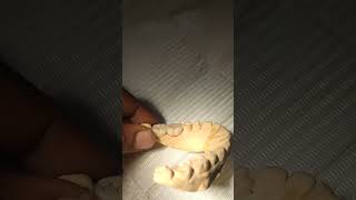 Metal ceramic crown dentalcare dentalclinic dentalhealth dentalhygiene dentalmakeover [upl. by Sada70]