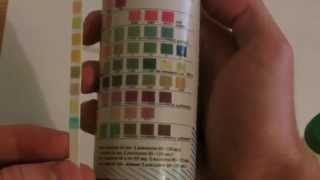 How to perform Urinalysis [upl. by Charron]