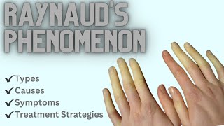 Raynauds Phenomenon Types Causes Symptoms and Treatment Strategies [upl. by Ogdan]