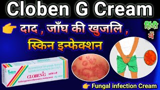 Cloben G Cream Uses in Hindi  Cloben cream use for Fungal infection  Skin disease Cream [upl. by Nishi]