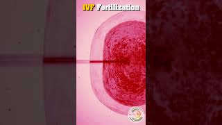 IVF Fertilization  Pravi IVF Shorts  Best IVF Hospital in Kanpur [upl. by Aiuhsoj]