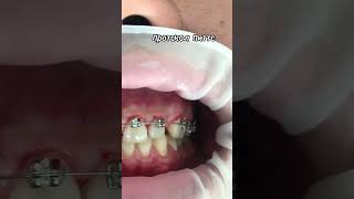 Breket Quva998907850999 remix minions dj music quva dentist funny orthodontist [upl. by Lamoree288]