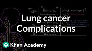 Lung cancer complications  Respiratory system diseases  NCLEXRN  Khan Academy [upl. by Reichert418]