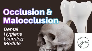 Occlusion and Malocclusion A Dental Hygiene Learning Module [upl. by Ajit859]