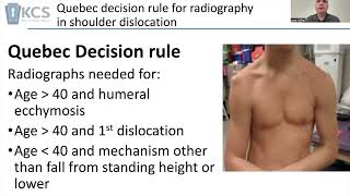 Shoulder Dislocation Management [upl. by Oranneg]