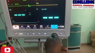 Setting Up different Display pattern for CONMEN 8000E multipara patient monitor [upl. by Ibson]