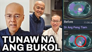 Doc Willie Ong WALA NG BUKOL PET SCAN ni Doc Willie MAY RESULTA NA [upl. by Crandall]