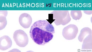 Anaplasmosis vs Ehrlichiosis Anaplasma phagocytophilum vs Ehrlichia chaffeensis amp ewingii [upl. by Schiffman260]