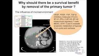 Cytoreductive Nephrectomy Survival Impact of Surgery in mRCC Axel Bex MD PhD [upl. by Narcis]