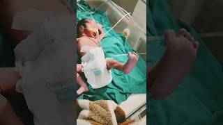 IUGR baby new born brithtrendings very critical conditionyoutubeviralvideo nicu support [upl. by Aneeras]