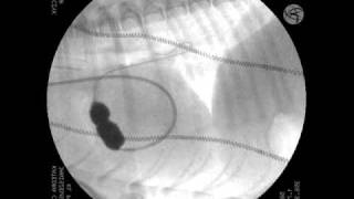 Percutaneous balloon pulmonary valvuloplasty in dog  Pulmonary Valve Stenosis [upl. by Johan140]