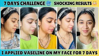 7 Days Challenge 🌸 I Applied Vaseline On My Face For A Week 🌸 Shocking Result 😱 skincare challenge [upl. by Hajidak222]