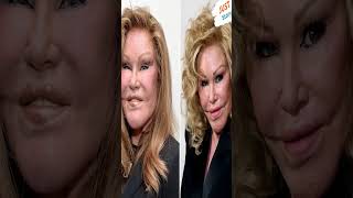 Jocelyn Wildenstein JocelynWildenstein catwoman SurgeryAddiction beauty celebritynews [upl. by Kort]