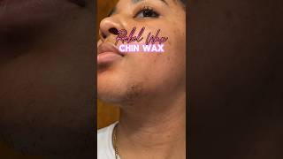 Pcos chin wax pcos chinwax [upl. by Agler953]