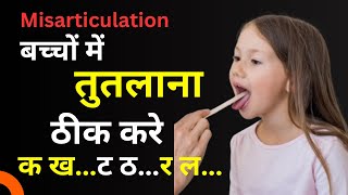 बच्चों की तुतलाने की समस्या दूर कैसे क़रे Misarticulation Problem In Childrens [upl. by Navac]