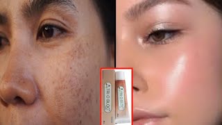 Safe Skin Whitening Cream  Doctors Recommend skin whitening cream  Skin Whitening  Pigmentation [upl. by Ssenav]