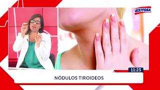 NÓDULOS TIROIDEOS  ANA BURGA CIRUJANA DE CABEZA Y CUELLO HEVES [upl. by Harutek]