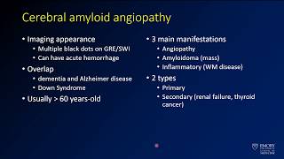 Imaging intracranial hemorrhage  Case 6  Cerebral amyloid angiopathy  CAA [upl. by Cly433]