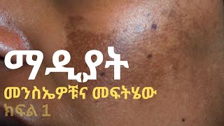 ማዲያት መንስኤዎቹና መፍትሄው [upl. by Sheelagh]