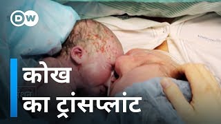 कोख के ट्रांसप्लांट ने जगाई उम्मीदें Uterus Transplants Provide New Hope [upl. by Ahseiuqal512]