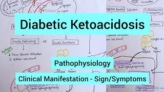 Diabetes Ketoacidosis  Pathophysiology Signs amp Symptoms [upl. by Eirelav714]