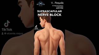 SUPRASCAPULAR NERVE BLOCK nerveblock nervepainrelief nerveblocks nervepaintreatment [upl. by Arytal883]