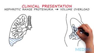 Nephrology – Proteinuria By Manish Suneja MD [upl. by Geiss]