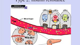 Debunking Type II Diabetes Mellitus Why and How [upl. by Ecnerol]