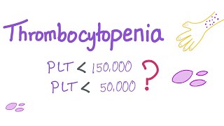 Thrombocytopenia  Why Is My Platelet Count Low [upl. by Nosyarg963]