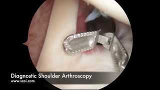 Basic Shoulder Arthroscopy [upl. by Steward]