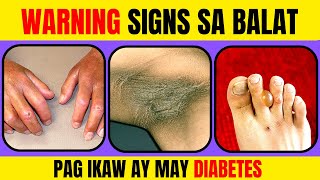 10 WARNING SIGNS of Diabetes sa Balat na Hindi Mo Alam Doc Cherry [upl. by Farrell671]