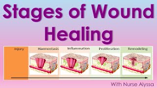 Stages of Wound Healing [upl. by Panthea]