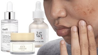 5 Korean Skincare Products to Treat Hyperpigmentation [upl. by Elitnahc]