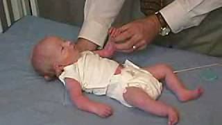 neurology exam newbornabnormal Primitive Reflexes  Moro [upl. by Harrie273]